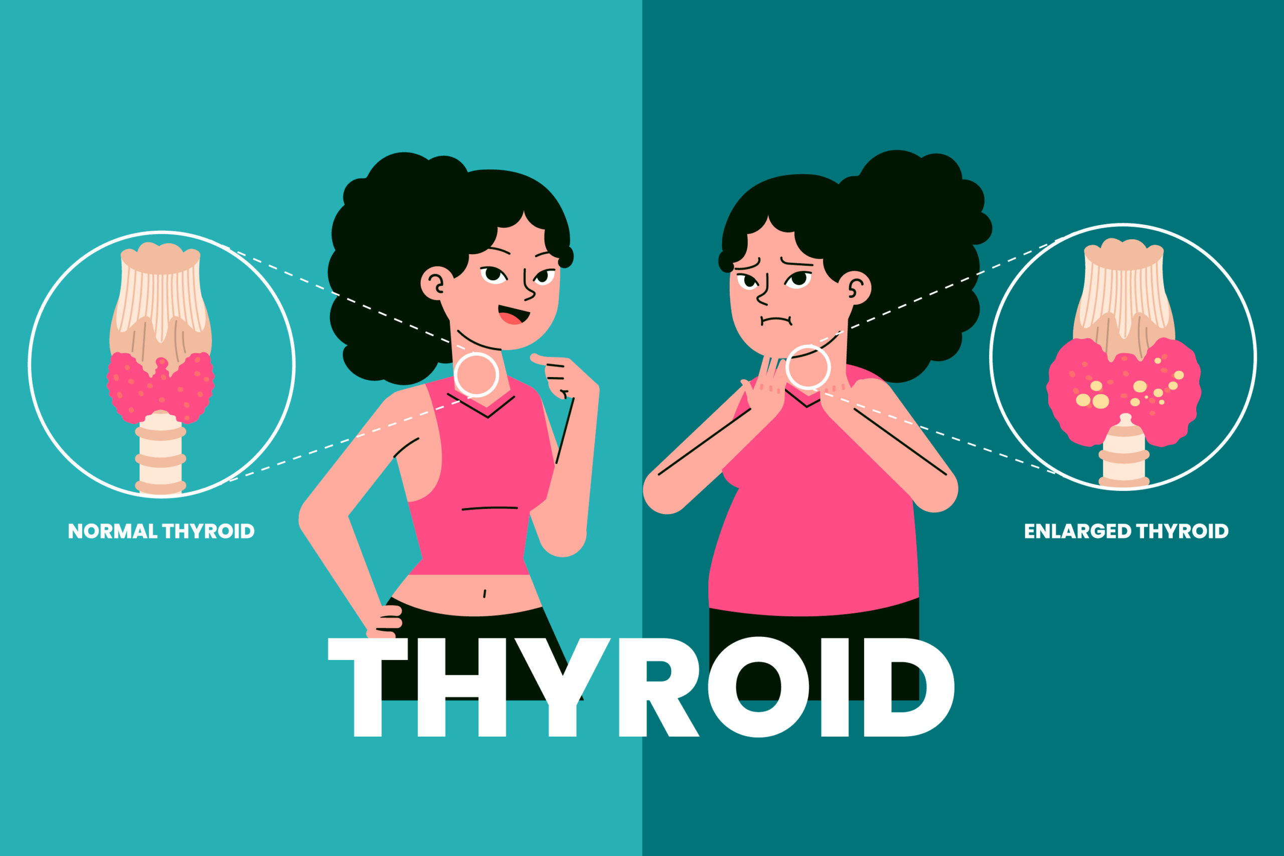 thyroid treatment